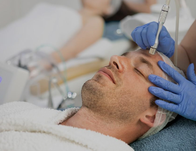 Microdermabrasion